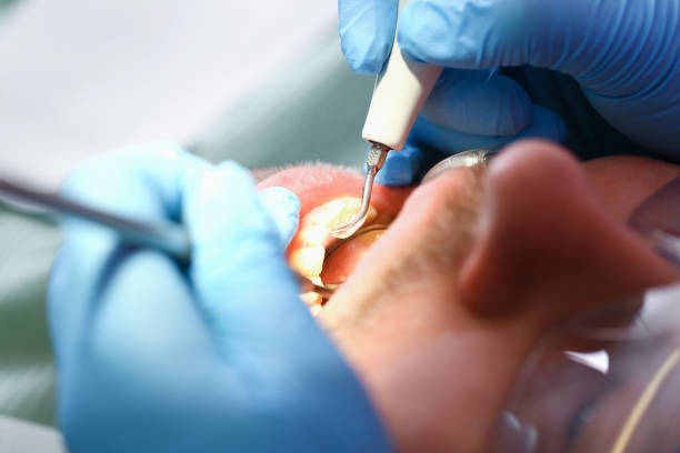Best Affordable Emergency Dental Care  in Beckett Ridge, OH
